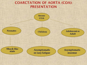 Presentation of coarctation of aorta