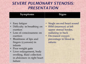 Presentation of Severe Pulmonary Stenosis