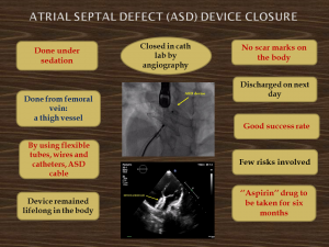 Management of Atrial Septal Defect (ASD)