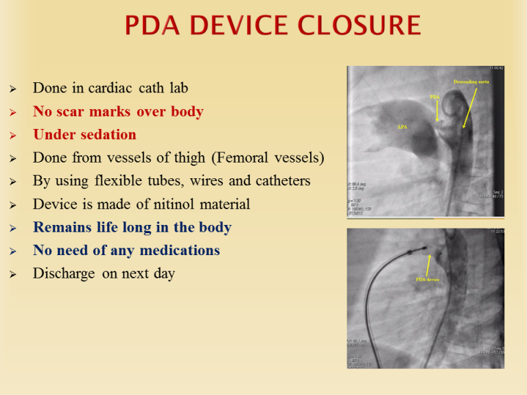 PDA Management Dr. Gaurav Agrawal