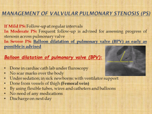 Management of “Valvular” Pulmonary Stenosis (PS)