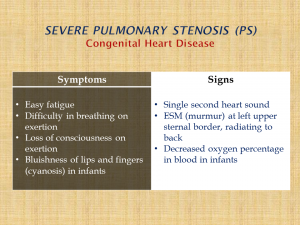 Presentation of Severe Pulmonary Stenosis (PS)