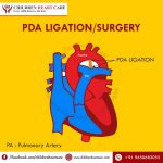 Best PDA Surgery in Delhi - Dr. Gaurav Agrawal