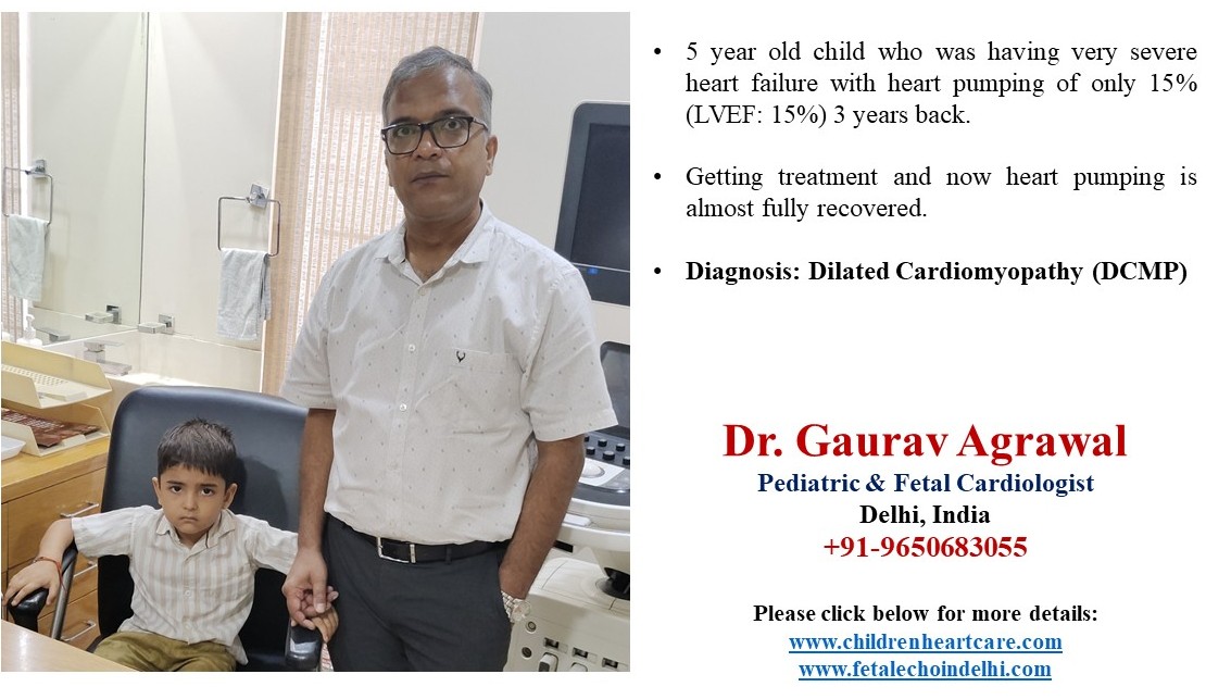 DILATED CARDIOMYOPATHY