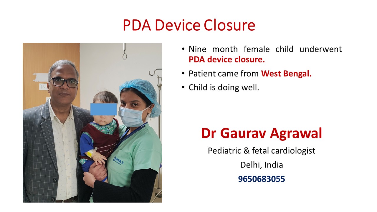 PDA DEVICE CLOSURE-1