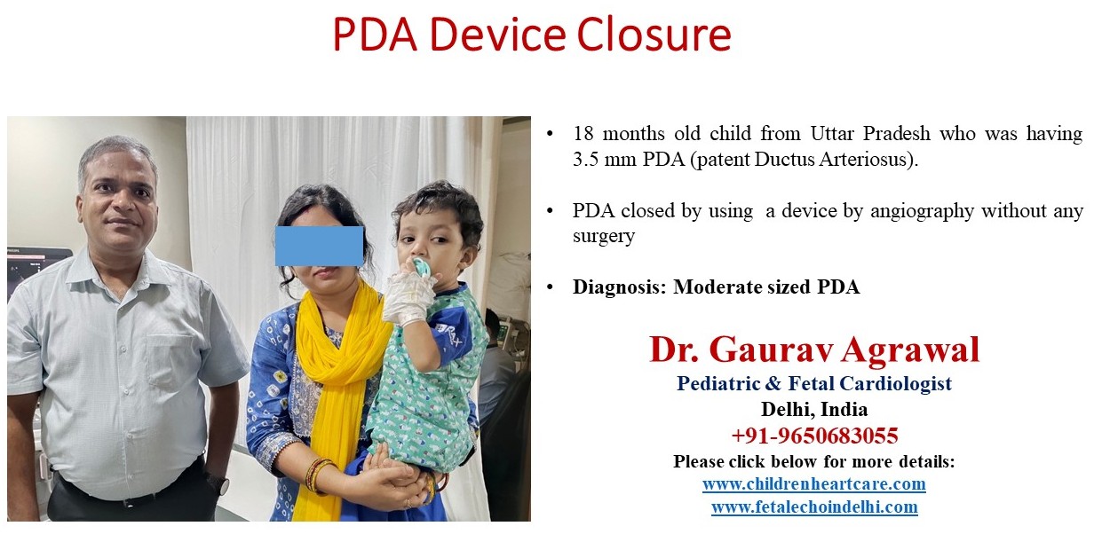 PDA DEVICE CLOSURE