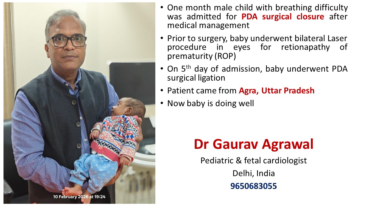 PDA SURGICAL CLOSURE